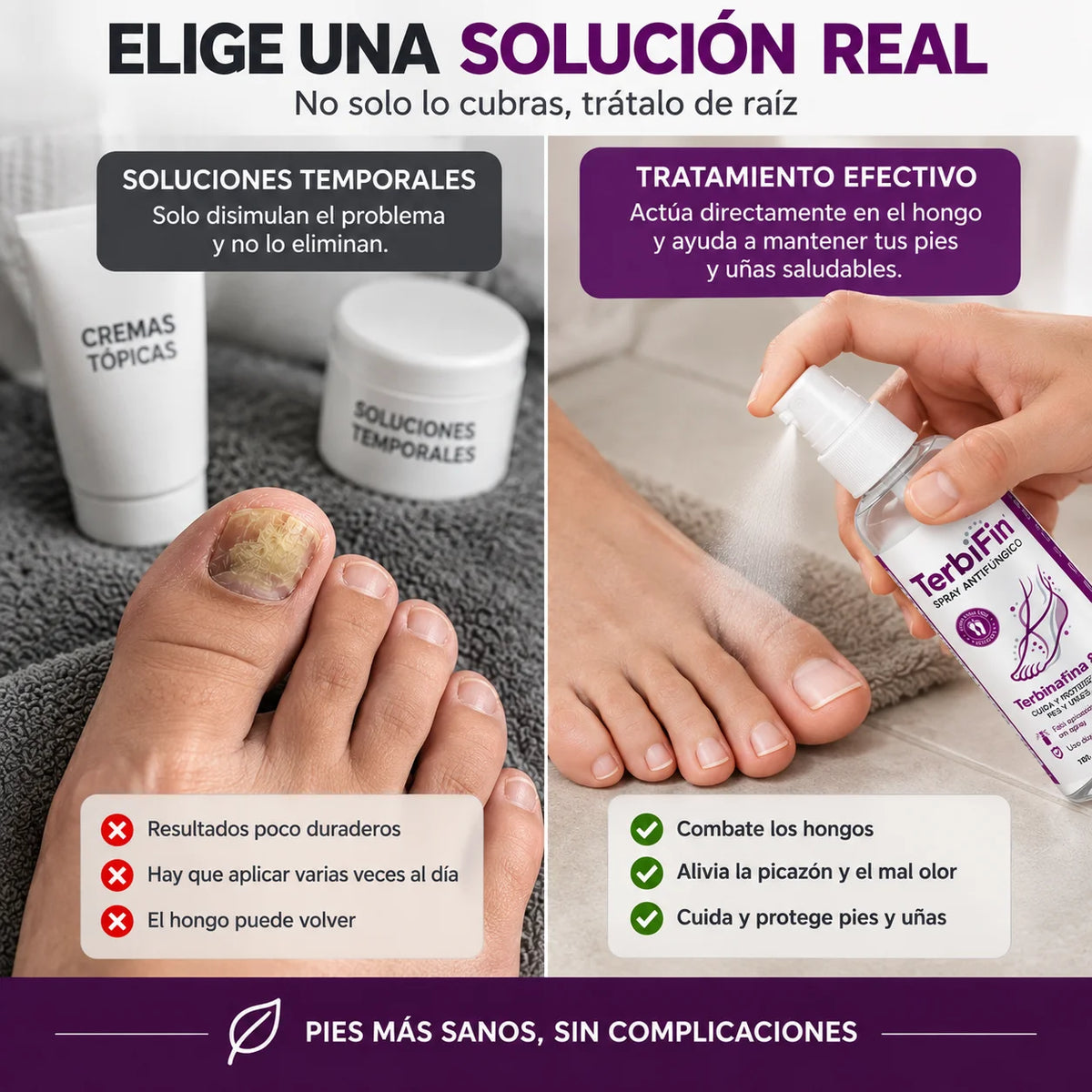 2x1 Spray Anti-Hongos y Picazón 100 ml - Tratamiento avanzado Pies y uñas